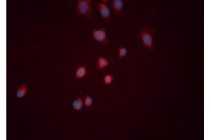 ABIN6276519 staining HeLa cells by ICC/IF. (CYR61 Antikörper  (Internal Region))
