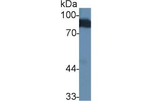 Detection of ANG in Human Serum using Polyclonal Antibody to Angiostatin (ANG) (Angiostatin Antikörper  (AA 79-466))