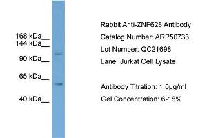 WB Suggested Anti-ZNF628  Antibody Titration: 0. (ZNF628 Antikörper  (Middle Region))