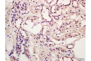 Formalin-fixed and paraffin embedded human kidney labeled with Anti-CCBR1 Polyclonal Antibody, Unconjugated (ABIN872924) at 1:200 followed by conjugation to the secondary antibody and DAB staining