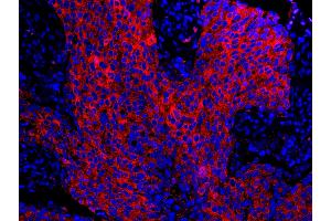 Immunofluorescence (IF) image for anti-Stratifin (SFN) (AA 198-248) antibody (ABIN7448925) (14-3-3 sigma/SFN Antikörper  (AA 198-248))
