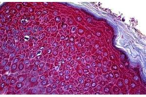 Human Skin: Formalin-Fixed, Paraffin-Embedded (FFPE)