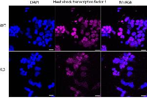 Immunocytochemical staining of 293T cells using Heat shock transcription factor 1 antibody (ABIN7798861), 1:1,000), Top panel: wild-type (WT), Bottom panal: Heat shock transcription factor 1 shRNA knockdown (KD).