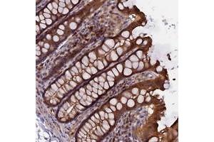 Immunohistochemical staining of human colon with CALY polyclonal antibody  shows strong cytoplasmic and membranous positivity in glandular cells.