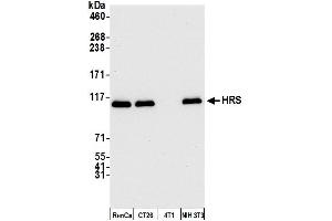 Western Blotting (WB) image for anti-HRS (HRS) (C-Term) antibody (ABIN7450342) (HRS (HRS) (C-Term) Antikörper)