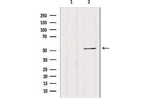Western blot analysis of extracts from 293, using CALCOCO2 antibody. (CALCOCO2 Antikörper  (Internal Region))