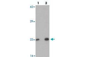 Western blot analysis of PHOX2B in 293 cell lysate with PHOX2B polyclonal antibody  at (lane 1) 1 and (lane 2) 2 ug/mL.