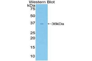 Western Blotting (WB) image for anti-Interleukin 22 Receptor (IL22R) (AA 267-565) antibody (ABIN1859402) (IL22R Antikörper  (AA 267-565))