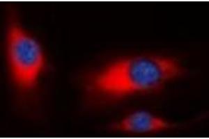 Immunofluorescent analysis of PAK1 staining in HeLa cells. (PAK1 Antikörper)