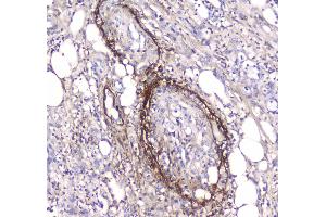 IHC analysis of Serum Amyloid P using anti-Serum Amyloid P antibody . (APCS Antikörper  (AA 20-220))
