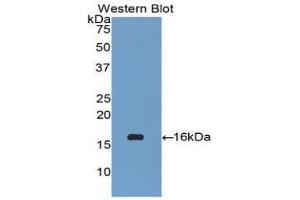 Western blot analysis of the recombinant protein. (CCL27 Antikörper  (AA 25-112))