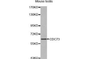 Western Blotting (WB) image for anti-Parafibromin (CDC73) (AA 435-505) antibody (ABIN1679121) (HRPT2 Antikörper  (AA 435-505))