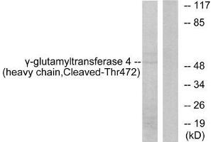 Western blot analysis of extracts from Jurkat cells, treated with etoposide (25uM, 24hours), using Gamma-glutamyltransferase 4 (heavy chain, Cleaved-Thr472) antibody. (GGT7 Antikörper  (Internal Region))