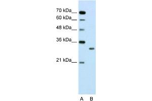 WB Suggested Anti-SBDS Antibody Titration:  2. (SBDS Antikörper  (N-Term))