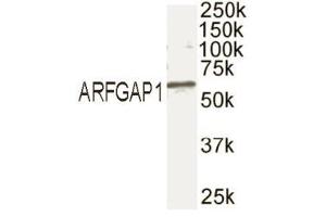 Western blot analysis of ARFGAP1 in mouse brain extract with ABIN121678. (RHOU Antikörper  (C-Term))