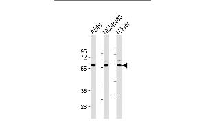 All lanes : Anti-Dsiglec-W20 at 1:2000 dilution Lane 1: A549 whole cell lysate Lane 2: NCI- whole cell lysate Lane 3: Human liver lysate Lysates/proteins at 20 μg per lane. (SIGLEC7 Antikörper  (N-Term))