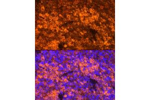 Immunofluorescence analysis of Mouse spleen using CCL5/RANTES antibody (ABIN6129369, ABIN6138063, ABIN6138065 and ABIN6218473) at dilution of 1:100. (CCL5 Antikörper  (AA 24-91))