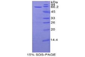 SDS-PAGE (SDS) image for Periplakin (PPL) (AA 1439-1716) protein (His tag,GST tag) (ABIN1877638) (PPL Protein (AA 1439-1716) (His tag,GST tag))