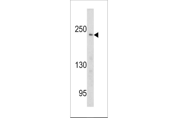 PCM1 Antikörper  (AA 632-661)