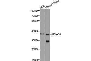 Western blot analysis of extracts of various cell lines, using UBIAD1 antibody (ABIN6293616) at 1:500 dilution. (UBIAD1 Antikörper)