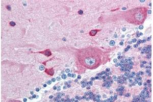 Human Brain, Cerebellum (formalin-fixed, paraffin-embedded) stained with PACSIN2 antibody ABIN293028 at 10 ug/ml followed by biotinylated goat anti-rabbit IgG secondary antibody ABIN481713, alkaline phosphatase-streptavidin and chromogen. (PACSIN2 Antikörper  (AA 400-450))