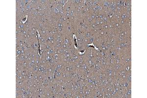 IHC analysis of EHD3 using anti-EHD3 antibody (ABIN7602777). (EHD3 Antikörper  (C-Term))