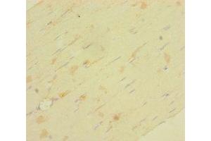 Immunohistochemistry of paraffin-embedded human skeletal muscle tissue using ABIN7158146 at dilution of 1:100