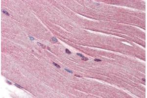 Human Skeletal Muscle (formalin-fixed, paraffin-embedded) stained with SH3GLB1 antibody ABIN334268 at 2. (SH3GLB1 Antikörper)