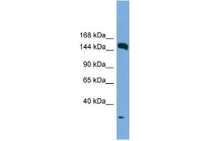 WB Suggested Anti-EEA1 Antibody Titration: 0. (EEA1 Antikörper  (N-Term))