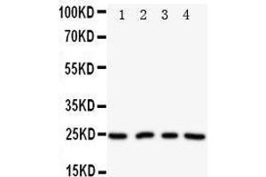 Anti-NPM2 antibody, Western blotting Lane 1: HELA Cell Lysate Lane 2: U87 Cell Lysate Lane 3: A549 Cell Lysate Lane 4: SMMC Cell Lysate (NPM2 Antikörper  (N-Term))