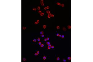Immunofluorescence analysis of Neuro-2a cells using TrkB Rabbit pAb (ABIN3022911, ABIN3022912, ABIN3022913 and ABIN6219292) at dilution of 1:150 (40x lens). (TRKB Antikörper  (AA 32-282))