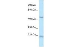 Image no. 1 for anti-One Cut Homeobox 1 (ONECUT1) (AA 370-419) antibody (ABIN6747414) (ONECUT1 Antikörper  (AA 370-419))
