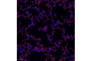 Immunofluorescence of paraffin embedded mouse lung using MRP1 (ABIN7074544) at dilution of 1:1000 (250x lens) (Multidrug-Resistance Like Protein 1 Antikörper)