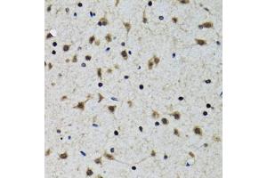 Immunohistochemistry of paraffin-embedded rat brain using SLC23A2 antibody (ABIN5974077) at dilution of 1/100 (40x lens). (SLC23A2 Antikörper)