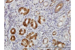 Immunoperoxidase of monoclonal antibody to TLN1 on formalin-fixed paraffin-embedded human stomach. (TLN1 Antikörper  (AA 1052-1149))
