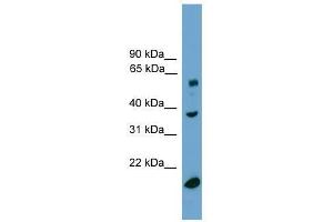 TBL1Y antibody used at 0. (TBL1Y Antikörper  (Middle Region))