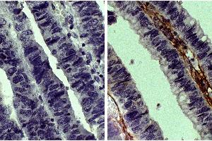 Immunohistochemistry (IHC) image for Goat IgG isotype control (Texas Red (TR)) (ABIN5706966)