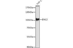 EML3 Antikörper  (AA 300-530)
