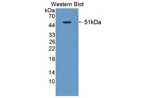 Detection of Recombinant BAFFR, Rat using Polyclonal Antibody to B-Cell Activation Factor Receptor (BAFFR) (BAFF Antikörper  (AA 21-169))