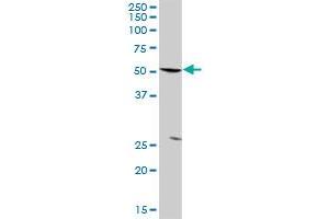 PFKFB3 MaxPab rabbit polyclonal antibody. (PFKFB3 Antikörper  (AA 1-520))