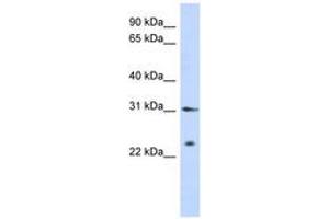 Image no. 1 for anti-Synovial Sarcoma, X Breakpoint 5 (SSX5) (AA 143-192) antibody (ABIN6742633) (SSX5 Antikörper  (AA 143-192))