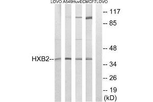 Western Blotting (WB) image for anti-Homeobox B2 (HOXB2) (Internal Region) antibody (ABIN1851452) (HOXB2 Antikörper  (Internal Region))