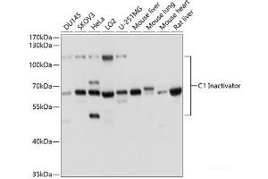 Western Blotting (WB) image for anti-Serpin Peptidase Inhibitor, Clade G (C1 Inhibitor), Member 1 (SERPING1) antibody (ABIN7259610)