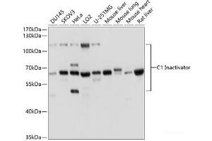 Western blot analysis of extracts of various cell lines using C1 Inactivator Polyclonal Antibody at dilution of 1:1000. (SERPING1 Antikörper)