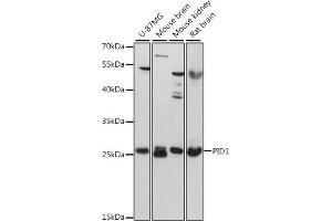 Western blot analysis of extracts of various cell lines, using PID1 antibody (ABIN6133302, ABIN6145610, ABIN6145611 and ABIN6217139) at 1:3000 dilution. (PID1 Antikörper  (AA 124-248))