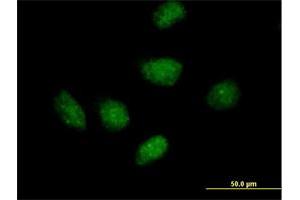 Immunofluorescence (IF) image for anti-RPA Interacting Protein (RPAIN) (AA 1-219) antibody (ABIN529629)