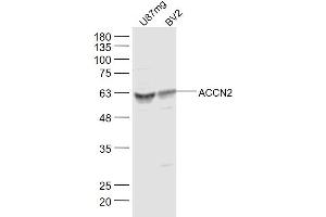 Lane 1: U87mg Cell lysates Lane 2: BV2 Cell lysates probed with ACCN2 Polyclonal Antibody, unconjugated  at 1:300 overnight at 4°C followed by a conjugated secondary antibody for 60 minutes at 37°C. (ASIC1 Antikörper  (AA 332-460))