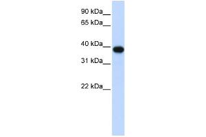 WB Suggested Anti-CDC2 Antibody Titration: 0. (CDK1 Antikörper  (Middle Region))