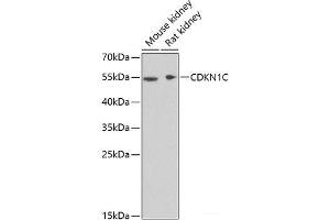 Western blot analysis of extracts of various cell lines using CDKN1C Polyclonal Antibody at dilution of 1:1000. (CDKN1C Antikörper)