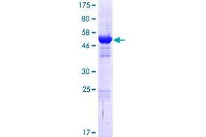 ACBD6 Protein (AA 1-282) (GST tag)